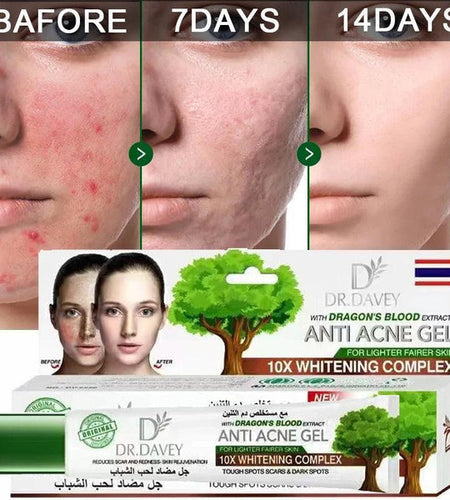ANTI ACNE GEL Dr Davey