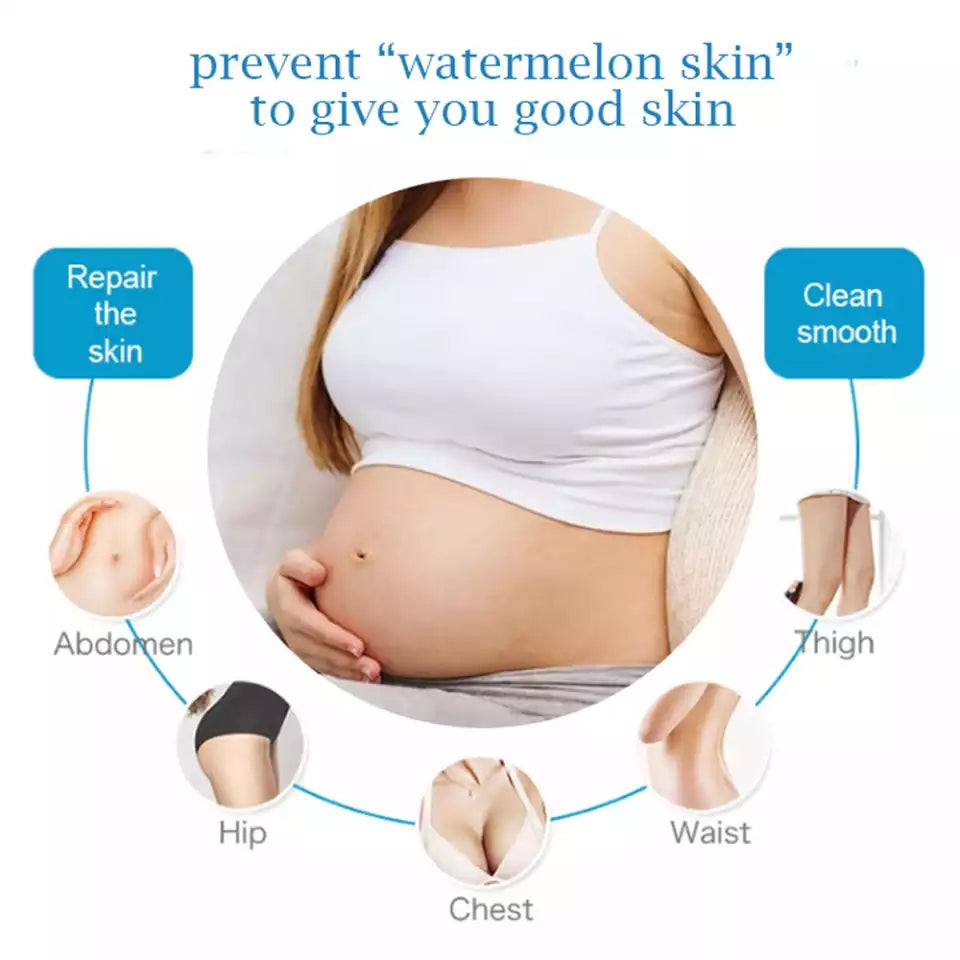 Guanjing Anti-Stretch Mark Cream