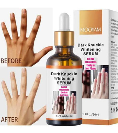 MOOYAM Dark knuckles whitening serum 50ml