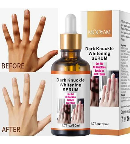 MOOYAM Dark knuckles whitening serum 50ml