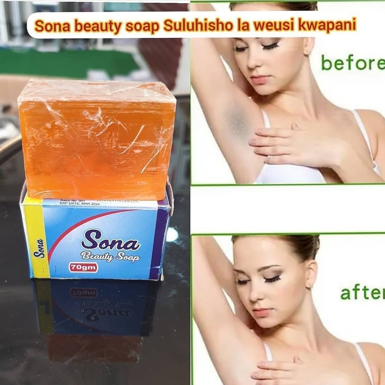 Sona Beauty Soap 70gm Komesha ya chunusi ya weusi kwapani